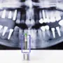 dental-implant-and-x-ray-picture-as-background-2026-01-07-06-35-23-utc.jpg