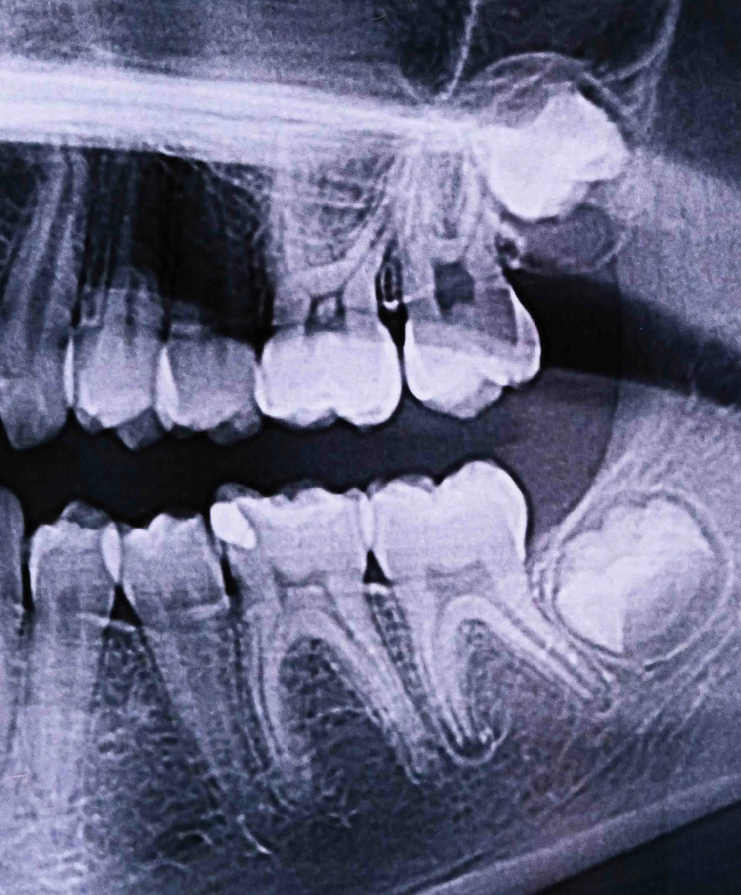 xray.jpg